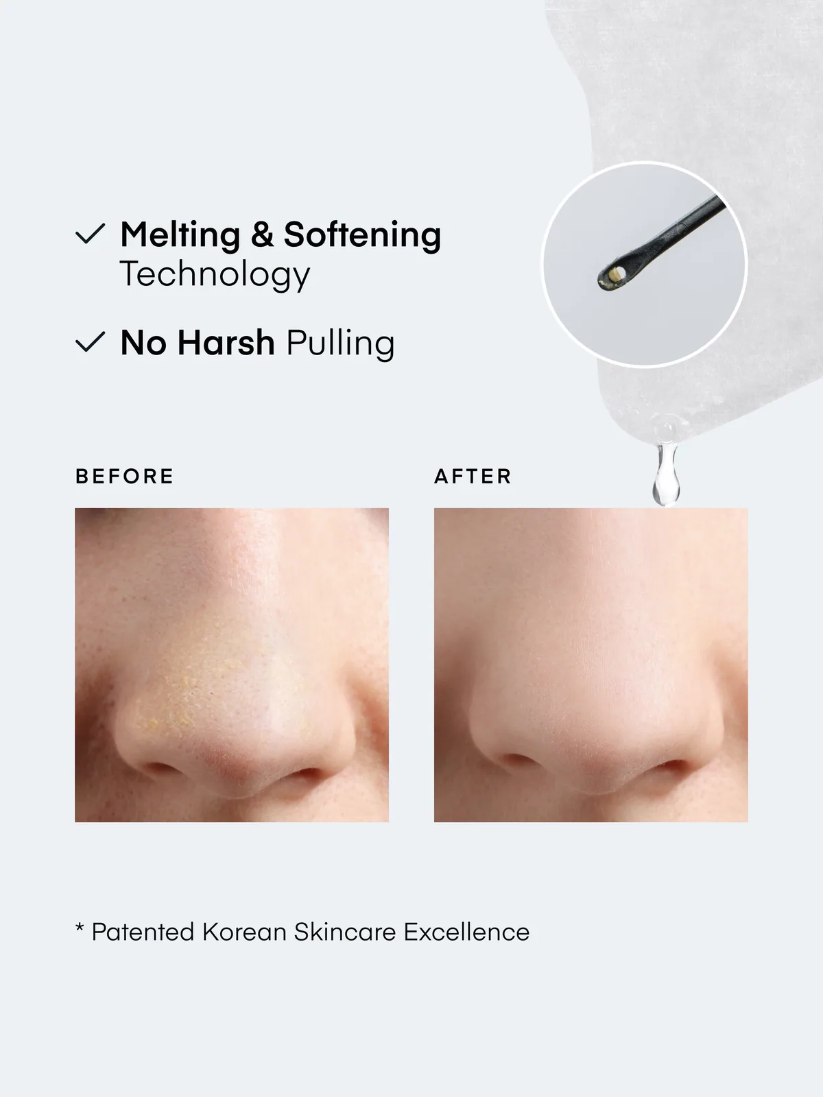 Blackhead Remover Nose Patch — product photo 4
