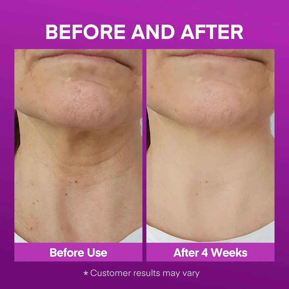 Neck Cream for Women — product photo 9