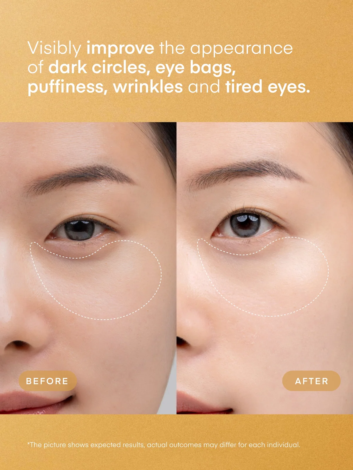 24K Gold Retinol Under Eye Patches — product photo 3