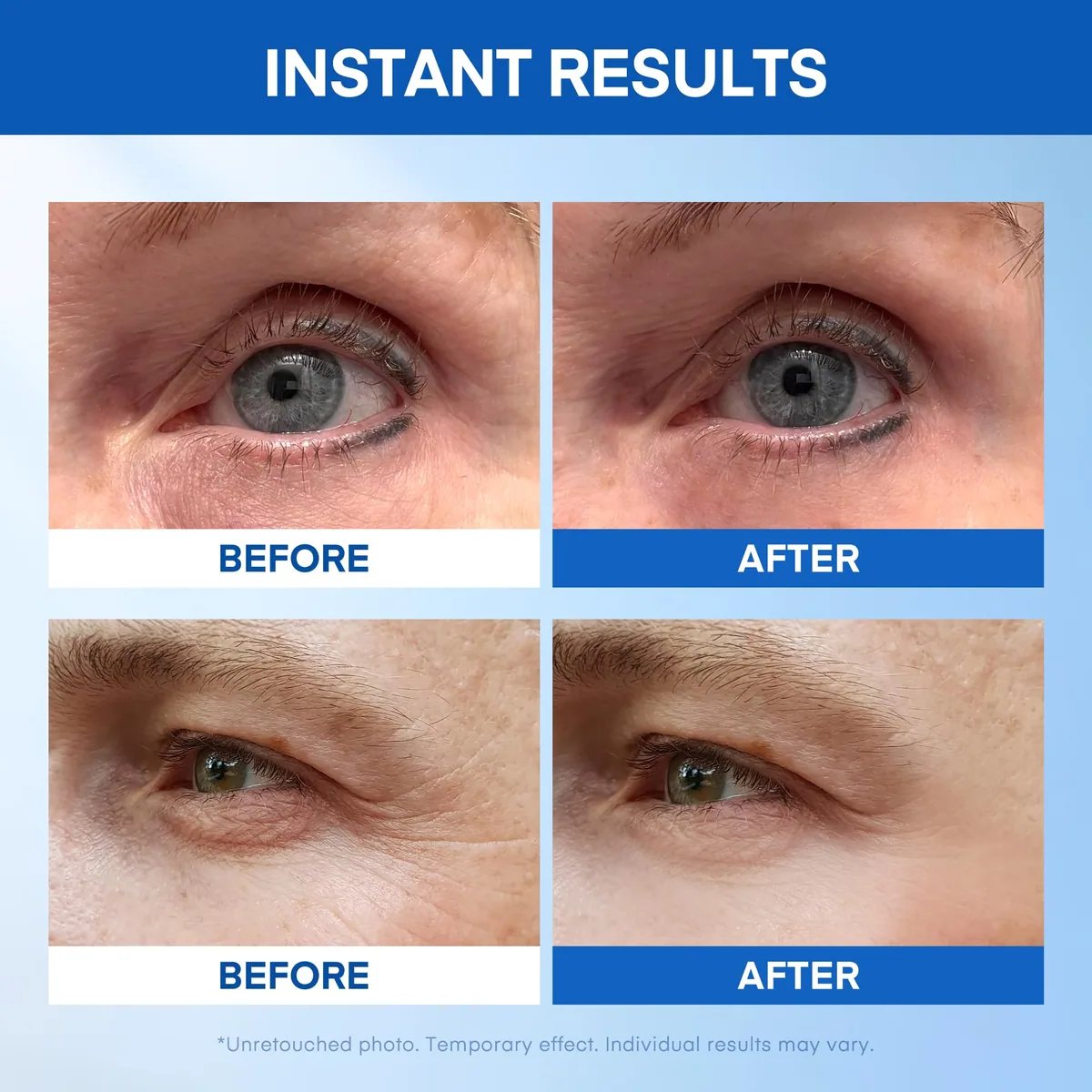 Under Eye Serum in Resealable Tubes — product photo 4