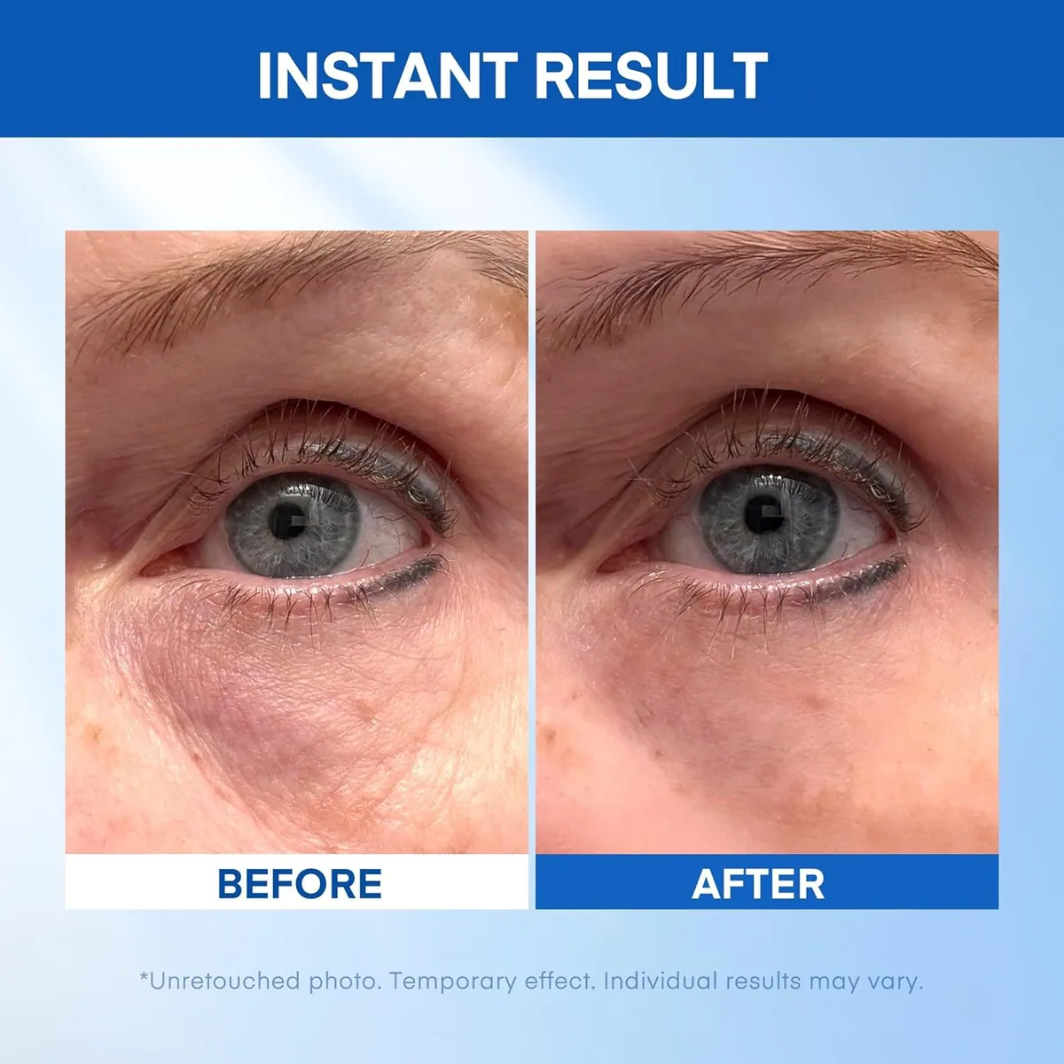 Under Eye Serum with Silicates — product photo 2